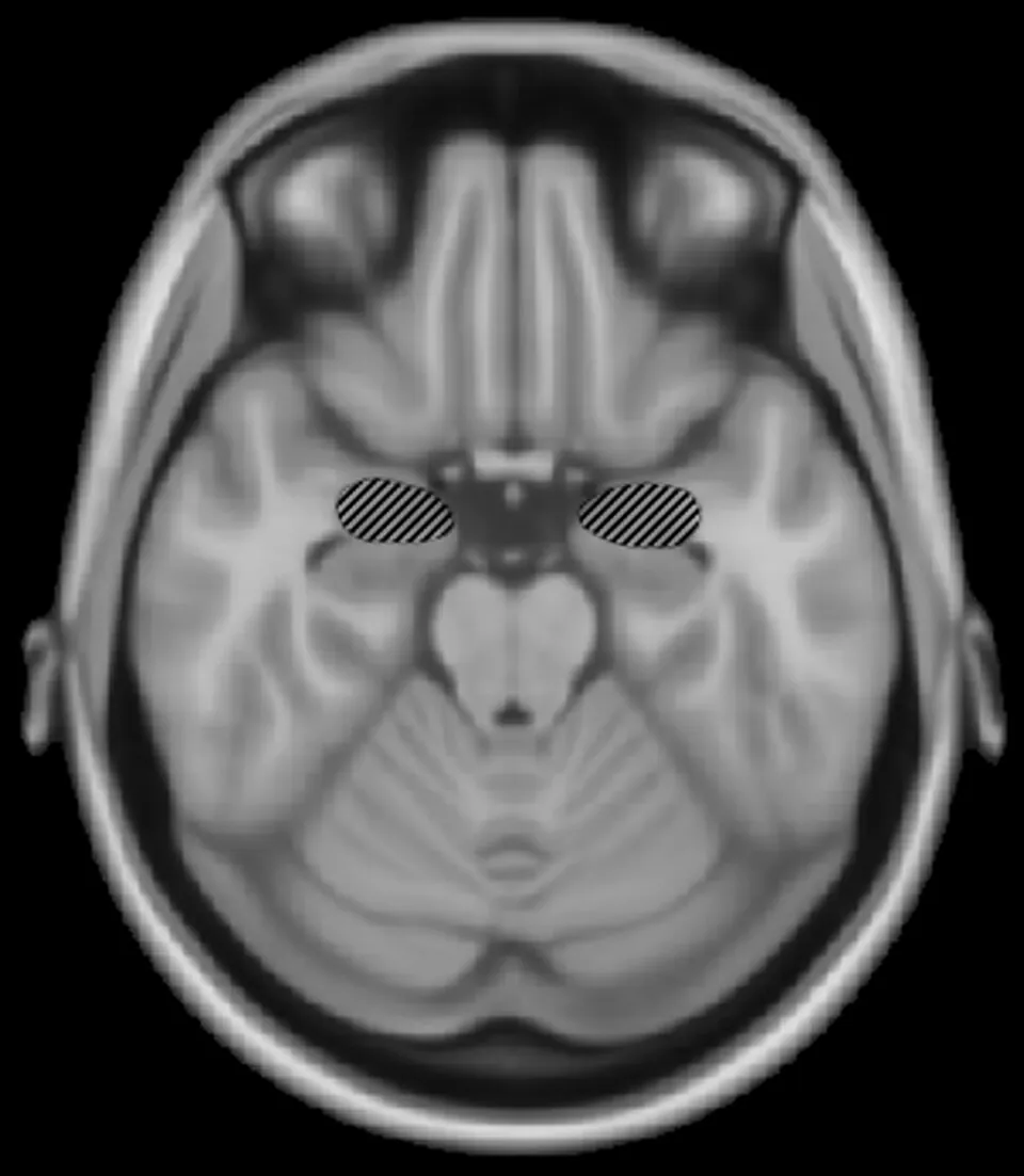 Anatomical image indicating the amygdala, one part of the broader neural circuitry involved in threat processing.