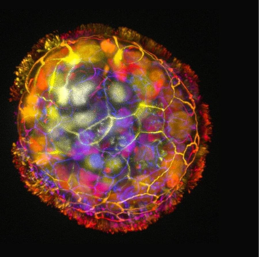 Multicoloured microscopic spheroid