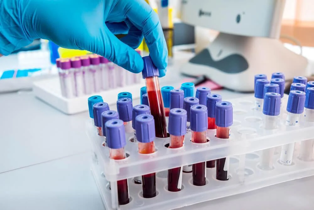 Blood sample tubes in a clinical laboratory